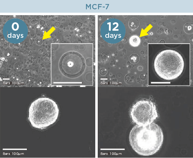 AGM３D培養でのスフェロイド形成例｜細胞カプセル化試薬（AGM™）｜ワン・テクノロジーズ・カンパニー